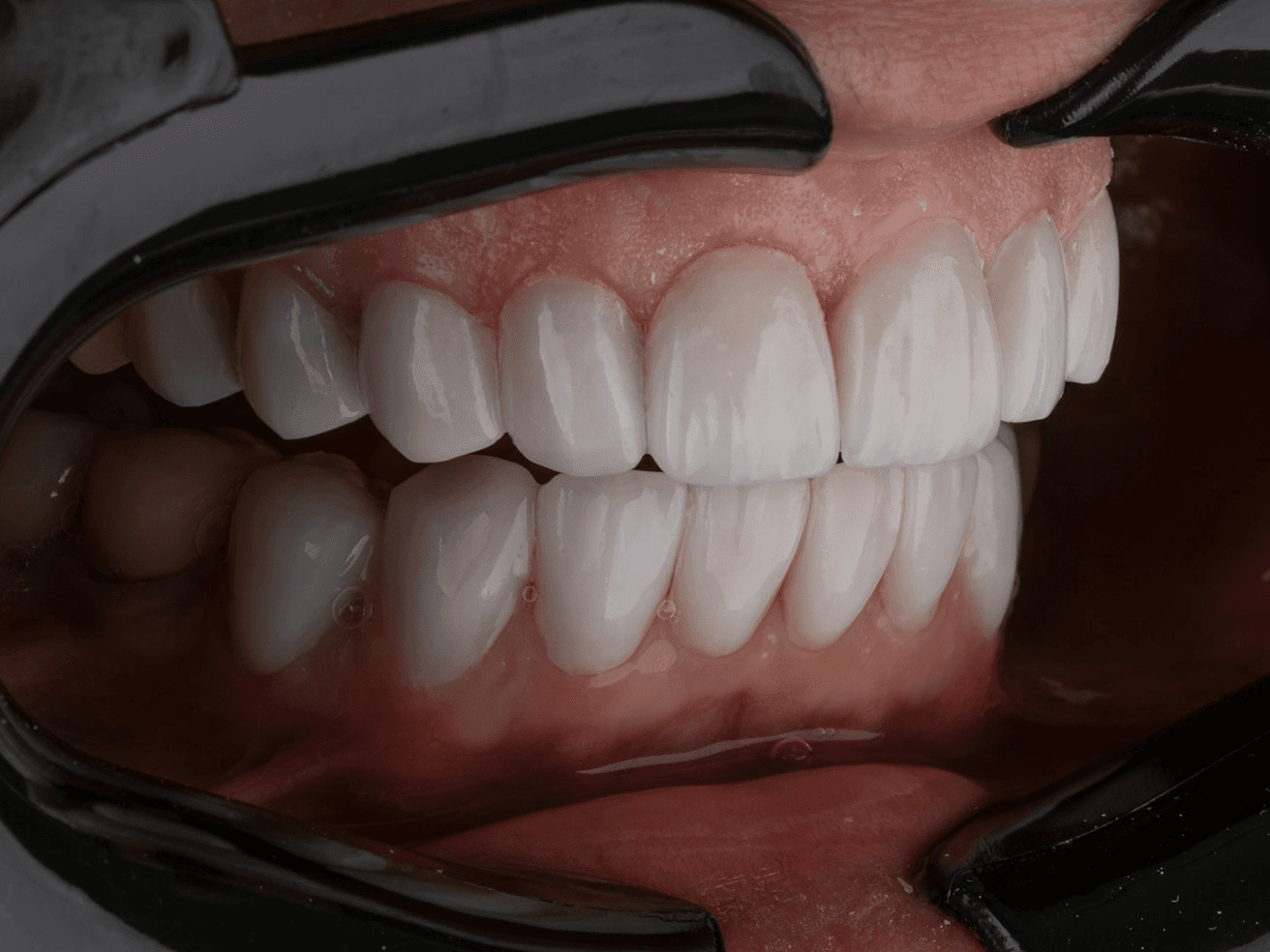 Approccio Estetica dentale