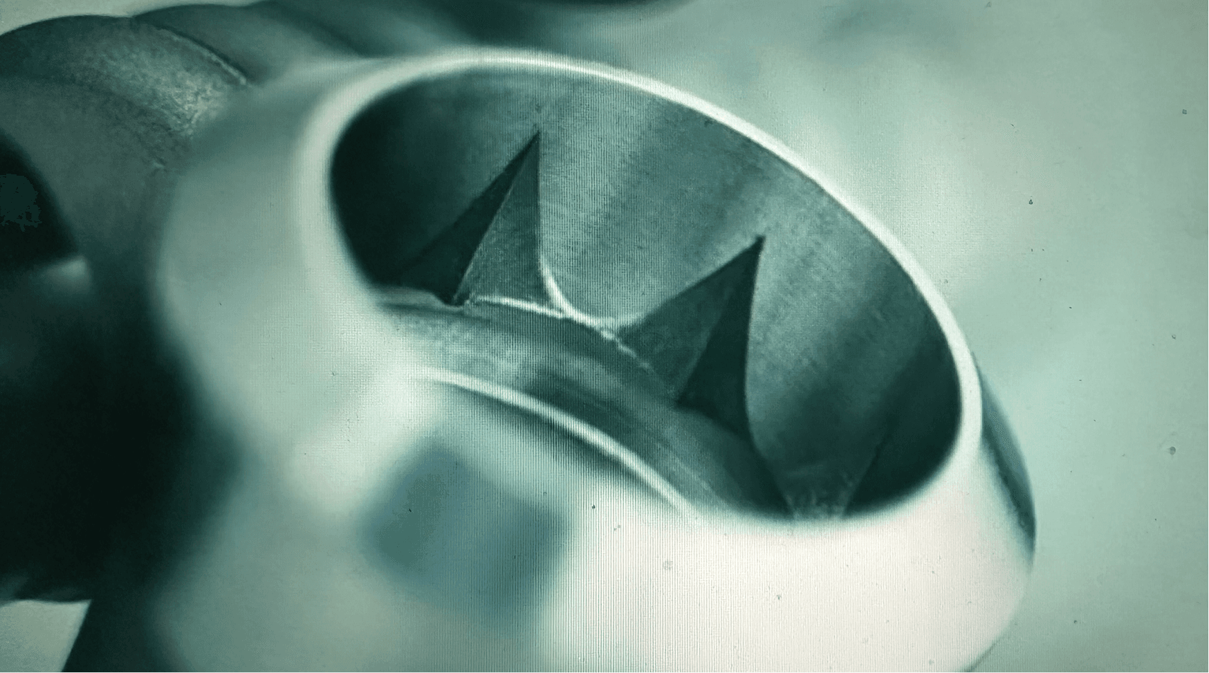 Approccio Implantologia dentale